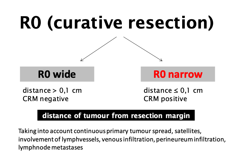 R0 (curative resection)