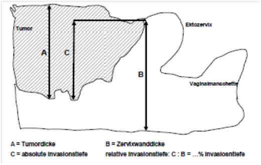 Bestimmung der Stromainfiltration