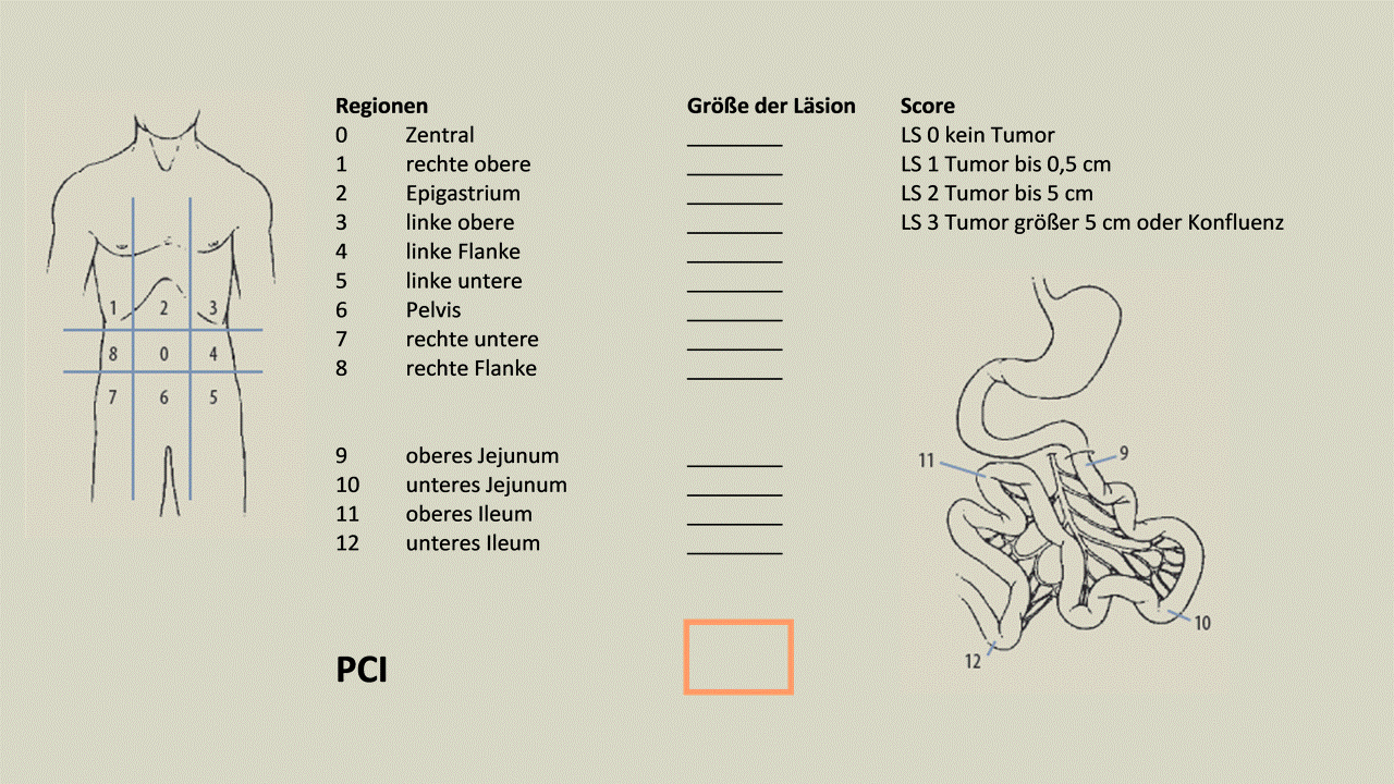 Erhebung des PCI (Peritoneal Carcinomatosis Index) nach Sugarbaker im Rahmen der Staging-Laparoskopie