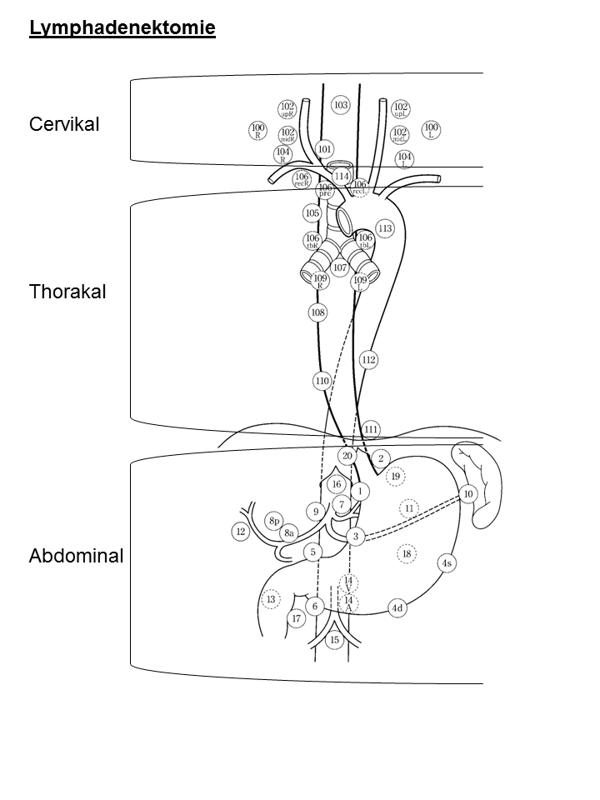Darstellung der verschiedenen Felder der Lymphadenektomie und der Lokalisation von Lymphknoten bei der Ösophagektomie (aus: Guidelines for Clinical and Pathologic Studies of Carcinoma of the Esophagus. Jap. Soc. for Esophageal Diseases, Tokyo 2001)
