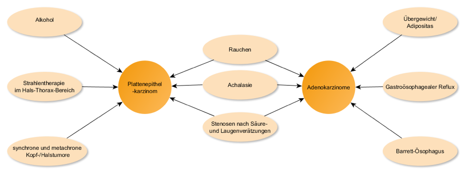 Bekannte Risikofaktoren für die Entstehung eines Ösophaguskarzinoms