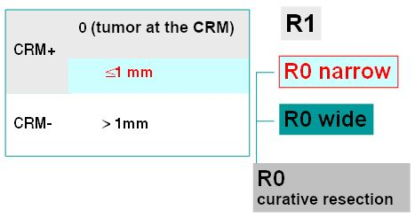 Concept of the circumferential resection margin (CRM) in pancreatic cancer