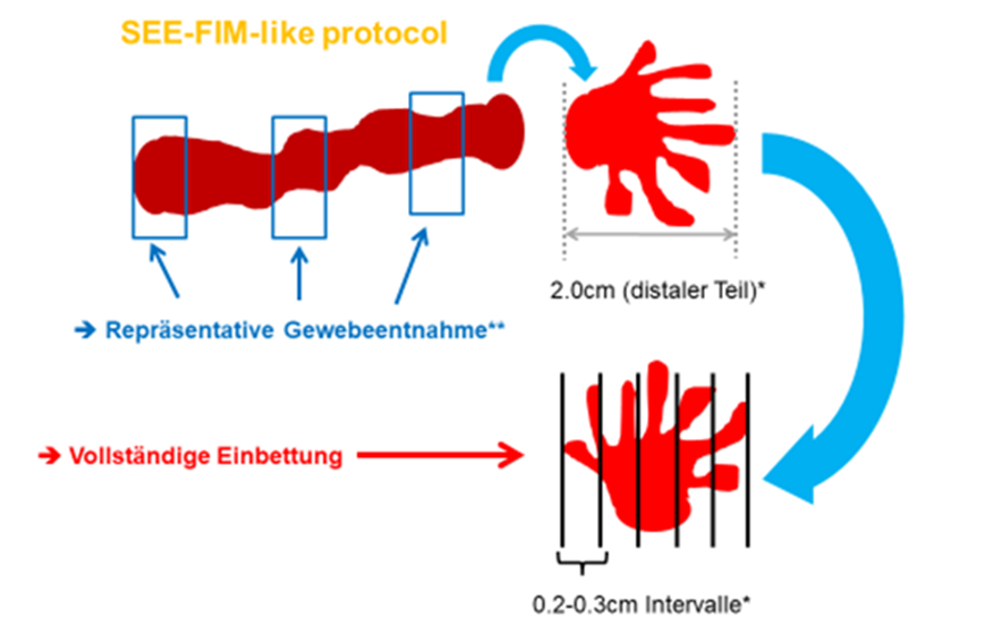 Aufarbeitung der Tuben beim Endometriumkarzinom nach dem SEE-FIM-like Protokoll