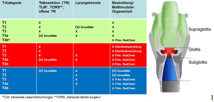 Übersicht Standards der Therapie des Larynxkarzinoms [198]